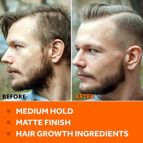 Thickening Hair Styling Pomade for Men - 1 Pack Medium Hold - Water Base, Matte Finish - Barber Mens Paste with Natural Hair Growth and Hair Loss ...