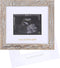 IHEIPYE Baby Love at First Sight Sonogram Keepsake Frame - Ultrasound Picture Frame - Pregnancy Announcement Frame for Expecting Parents, Gender R...