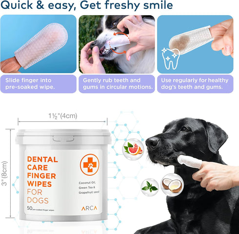 Dental Finger Wipes for Dogs - 100 Wipes - Dog Dental Teeth Cleaning Wipes for Dogs - Pre-Soaked Oral Cleaning Pads- Reduces Plaque, Tartar & Dog ...