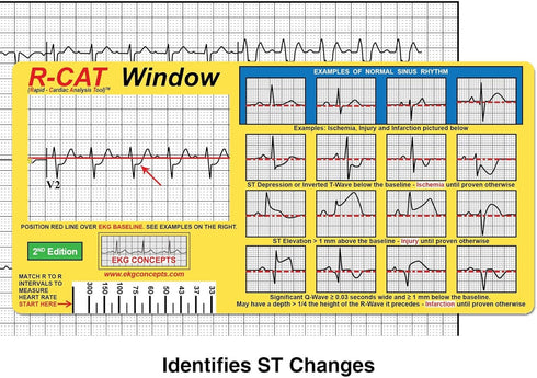 R-CAT EKG Window 2nd Edition...