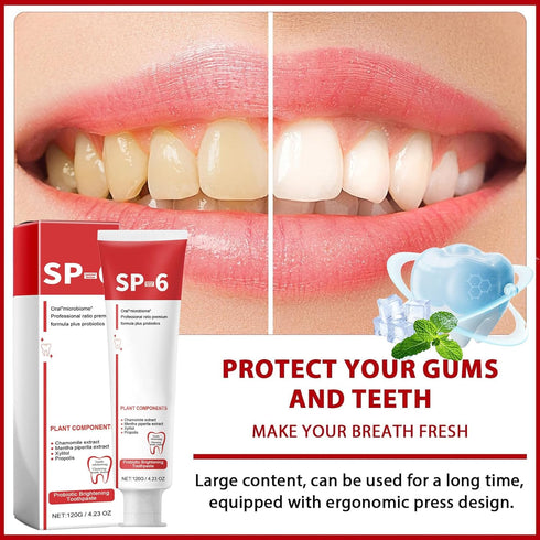 Sp-6 Ultra Whitening Toothpaste, Upgrade - 2PCS Sp6 Probiotic Brightening Toothpaste, Fresh Breath, Deep Cleaning & Care 120g...