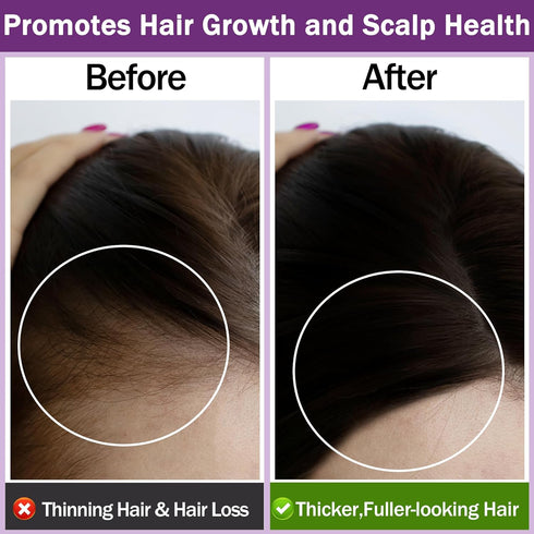 Organic Rosemary Oil for Hair Growth,100% Pure Undiluted Light-Weight Non-Greasy Rosemary Essential Oil for Hair,Scalp & Skin Care,Natural Hair Gr...