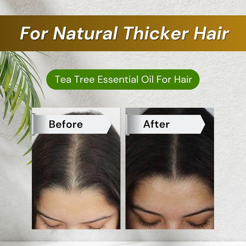 Organic Tea Tree Oil - 100% Pure Tea Tree Oil for Skin, Hair, Toenails, Scalp, Acne - Tea Tree Essential Oil for Aromatherapy - 1 oz/30ml...