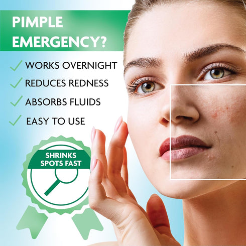 Pimple Patches for Face | Hydrocolloid Acne Patches for Face | Invisible Pimple Patch | Zit Patches for Face | Acne Patch | Zit Stickers | Acne Do...