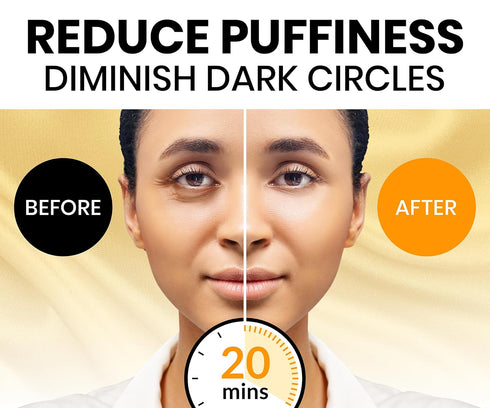 Under Eye Patches for Dark Circles and Puffy Eyes (30 Pairs), 24k Gold Eye Mask for Dark Circles and Puffiness with Vitamin C, Hyaluronic Acid, an...