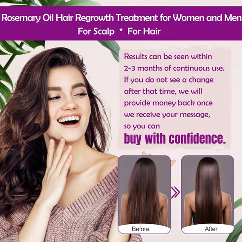 Rosemary Oil Hair Growth Serum W/Rosemary Water & Rice Water Spray Hair Growth,Biotin Castor Oil Argan Oil Caffeine Keratin Reduce Hair Loss,Resto...