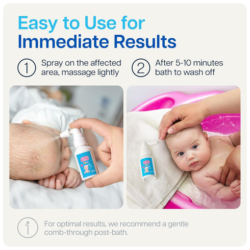 NAVEH PHARMA Cradle Cap Cleanser For Baby & Kids | 100% Natural Cradle Cap Treatment | Spray & Wash No Scrubbing | Better Than Shampoo Or Brush | ...