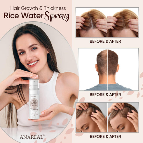 Rice Water for Hair Growth, Hair Growth Serum Women, Rice Water, Rice Water Spray, Rice Water for Hair, Rice Water Spray that can be used with Ric...