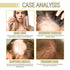 60ML Natural Hair Regrowth Oil, Rosemary Oil for Dry, Damaged and Thin Hair, Grow Hair(2FL Oz)...