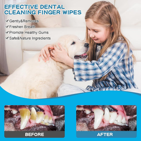Dog Teeth Cleaning Wipes Nature Pet Dental Finger Wipes for Dogs Cats Remove Bad Breath,Reduce Plaque and Tartar Buildup Disposable Gentle Pet Den...
