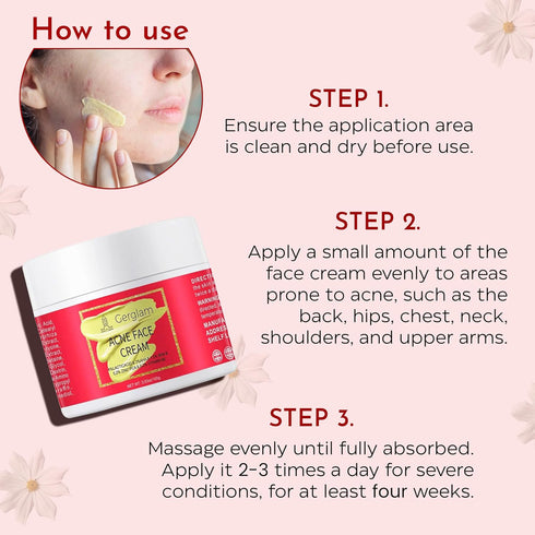 Acne Spot Treatment for Face - Advanced Acne Cream with Salicylic Acid, Pimple and Blemish Spot Treatment, Cystic Acne Treatment & Acne Medication...