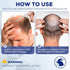 5% Minoxidil for Men, Minoxidil for Women Hair Growth, Minoxidil for Beard Growth, Hair Regrowth for Men, Minoxidil 5 Percent Hair Loss Treatments...