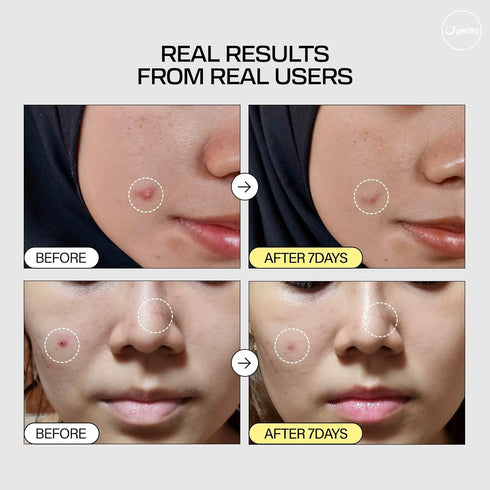 JUMISO Snail Mucin 95% + Peptide Essence 4.73 fl.oz / 140ml | Hydrating Serum with Snail, Face Moisturizer for Dry Skin, Daily Deep Hydration, Kor...