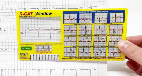 R-CAT EKG Window 2nd Edition...