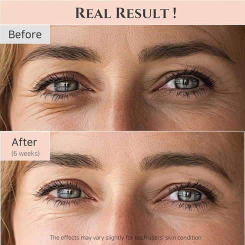 Beauty of Joseon Revive Eye Serum with Retinal Niacinamide Correction for Puffy Eye Bags Fine Lines Dark Circles Wrinkles, Korean Skin Care 30ml, ...