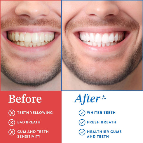 Coconut Oil Pulling for Teeth and Gums (Made in USA), Whitening Pulling Oil Coconut Mint Mouthwash for Fresh Breath Ayurvedic Oil Pulling Mouth Gu...