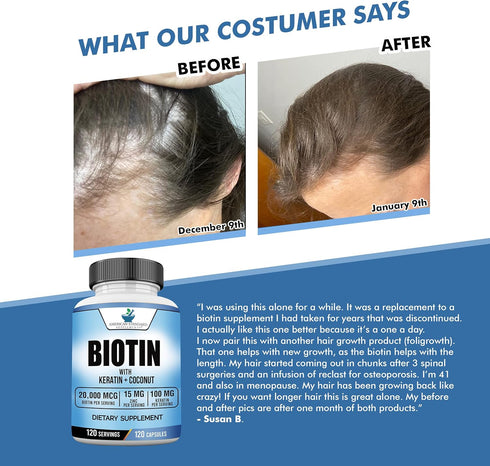 Biotin 20,000mcg with Keratin, Coconut Powder and Zinc, Hair Growth Supplements, Biotin Supplements, Healthy Hair Skin & Nails for Adults,120 Vegg...