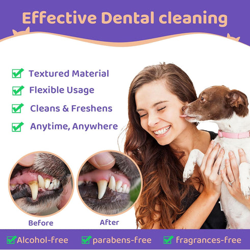 Dog Teeth Cleaning Wipes, Teeth Cleaning Finger Wipes for Dogs & Cats, Dog Dental Care Finger Wipes, Disposable Gentle Cleaning & Gum Care Pet Tee...
