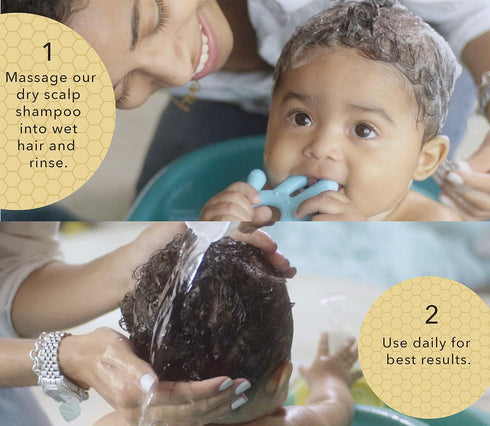 BELLA B Bee Gone Cradle Cap Baby Shampoo 8 oz - Natural Dry Scalp Shampoo - Cradle Cap Shampoo Treatment For Babies - Organic Baby Shampoo...