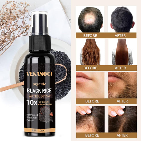 Venanoci Hair Growth Serum, Rice Water Spray for Women & Men Treatment For Hair Loss, Damaged Dry Hair, Hair Regrowth for Thicker Longer Fuller Ha...
