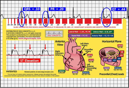 R-CAT EKG Window 2nd Edition...