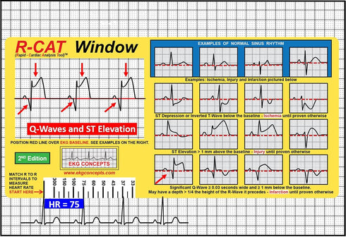 R-CAT EKG Window 2nd Edition...