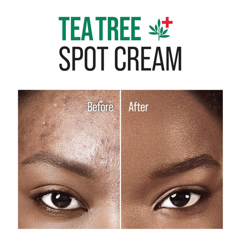 Tea Tree Spot Cream Korean Skincare Lightweight Face Spot Cream for Blemishes...