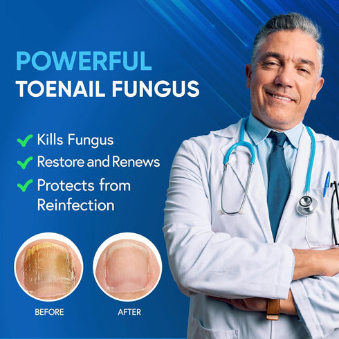 Toenail Fungus Treatment For Toenail & Finernails, 25% Undecylenic acid, Toe Nail Fungus Treatment Extra Strength, Tea Tree Oil for Tonail Fungus ...