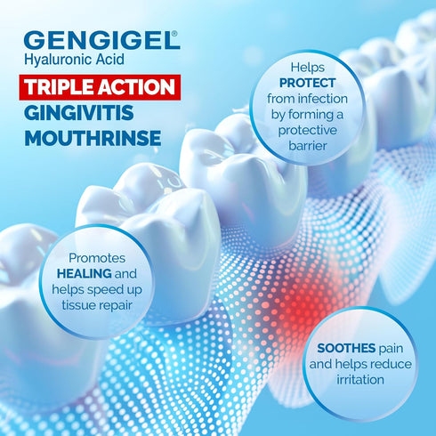 Hyaluronic Acid Mouthrinse (150 ml), Oral Care Solution for Gum Health, Reduces Discomfort & Promotes Healing, Relieves Gum Recession & Gingivitis...