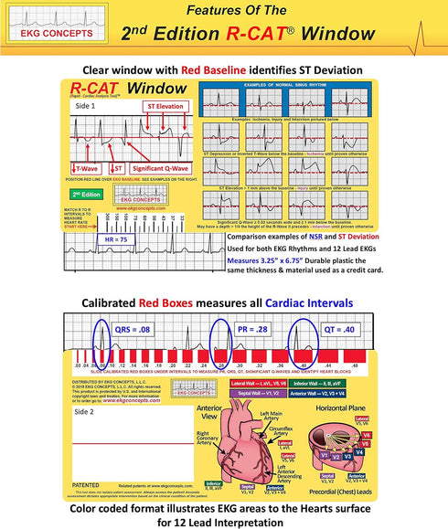 R-CAT EKG Window 2nd Edition...