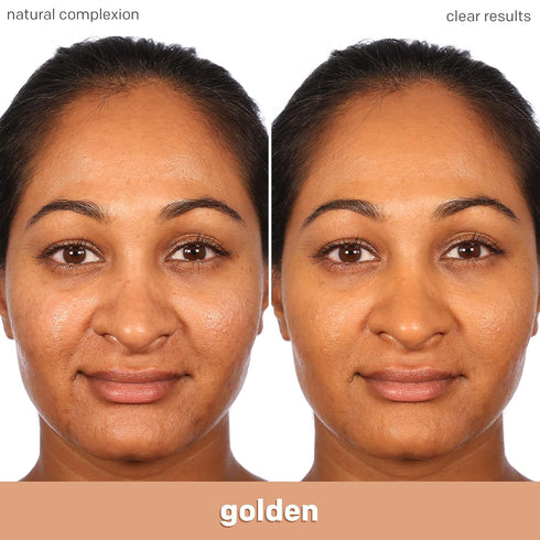 Almay Clear Complexion Acne Foundation Makeup with Salicylic Acid - Lightweight, Medium Coverage, Hypoallergenic, Fragrance-Free, for Sensitive Sk...