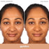 Almay Clear Complexion Acne Foundation Makeup with Salicylic Acid - Lightweight, Medium Coverage, Hypoallergenic, Fragrance-Free, for Sensitive Sk...