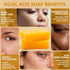 Organic Honey Turmeric Kojic Acid Soap. Dark Spot Remover Soap Bars with Vit C, Retinol, Collagen, Turmeric - Complex Infused with Hyaluronic Acid...