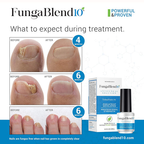 Antifungal Medication:1% Tolnaftate and 10 Plant Medicines -Toenail Fungus Treatment for Nail Repair Gel, Athletes Foot, Jock Itch, Ringworm -Topi...