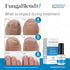 Antifungal Medication:1% Tolnaftate and 10 Plant Medicines -Toenail Fungus Treatment for Nail Repair Gel, Athletes Foot, Jock Itch, Ringworm -Topi...