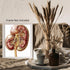 Posterizer 1 pcs-anatomical illustration of the human kidney 3-Teachers & Classrooms-Abstract & Modern Art-School and classroom art- unframed wall...