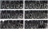 Hardline Products Series 200 Factory Matched 3-Inch Boat & PWC Registration Number Kit, Chrome/Black - CHBKG200...