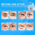 Enaskin Naturals Under Eye Patches for Dark Circles: 30 Pairs Retinol Collagen Eye Gels Mask - Reduce Wrinkles Puffy & Bags - Skin Treatment Pads ...