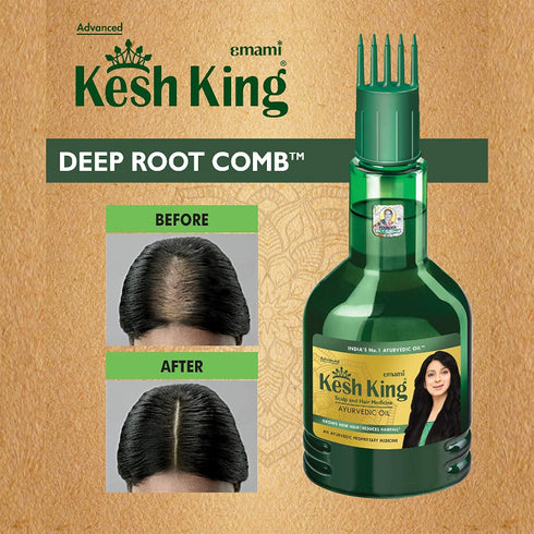 Ayurvedic Hair Oil | Herbal Oil with Bhringraj & Amla | Enhance Hair Growth | Reduce Hairfall | Nourishes Scalp | Provides Long & Thick Hair | 10....