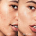 e.l.f. SKIN Blemish Breakthrough Blemish Control Basics Kit, Travel-Size Acne Skincare Routine, Cleanser, Serum & Moisturizer, Vegan & Cruelty-Fre...