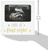 Tiny Ideas Love at First Sight Sonogram Keepsake Photo Frame, Ultrasound Photo Frame for Baby Girl or Baby Boy