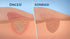 Bepanthen Scar Treatment 20g