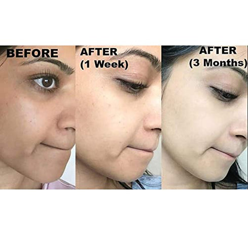 Original Kojie San Body Lotion - Controls Hyperpigmentation and Reduces the Appearance of Visible Skin Blemishes - Guaranteed Authentic (150ml)