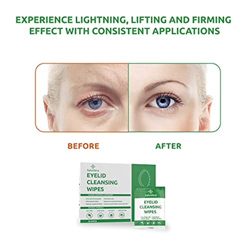 SaluVera Eyelid Wipes with Tea Tree Oil and Aloe Vera | Eye Cleansing Wipes for Dry and Itchy Eyes Relief | Natural Ingredients Eyelid Scrub for Daily Usage - Pack of 30
