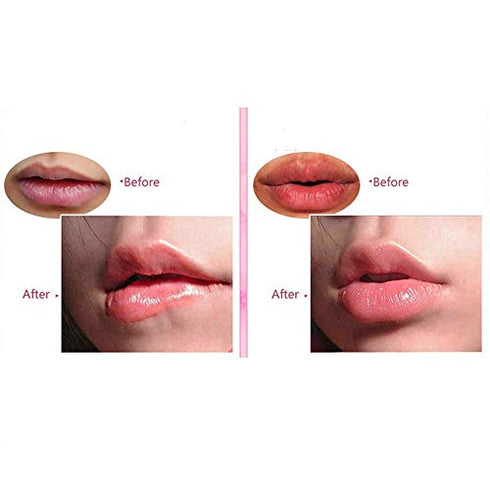 DELISOUL 20 Pieces Crystal Lip Masks Pink Collagen Lip Pads Sheet for Moisturizing, Remove Dead Skin, Anti-Wrinkle, Anti-Aging, Hydrating and Plump Your Lips