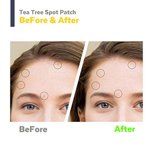 hellocell Tea Tree Spot Patch 90 dots - small, invisible, bandaids, Salicylic Acid, Acne, blemishes, Spot, Cover, Acne, Pimple, Blemish, Face, Stickers, 0.55 Inch, Patches
