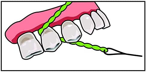 IDontix Brace X-Floss, Green