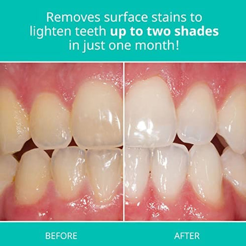 Opalescence Whitening Toothpaste for Sensitive Teeth - Oral Care, Mint Flavor, Gluten Free - 2 Pack