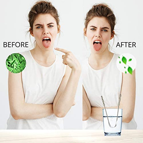 AVOOLI Metal Tongue Scraper with Case, Pack of 2 - Stainless Steel Tounge Scraper Cleaner for Bad Breath Remover, Tongue Cleaner for Adults, Metal Tounge Scrappers, Oral Hygiene Toungescrapper Kit