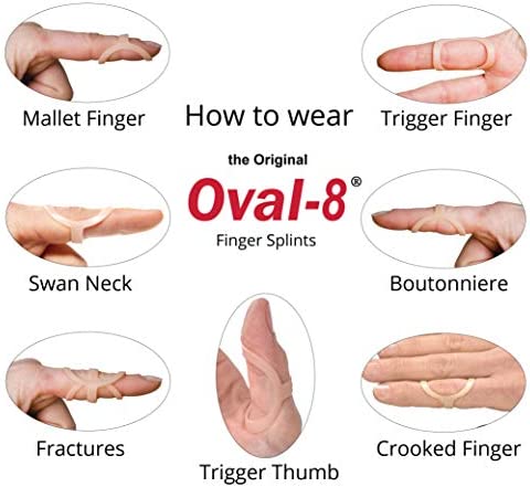 Oval-8 Finger Splint Graduated Set - Sizes 8, 9, 10
